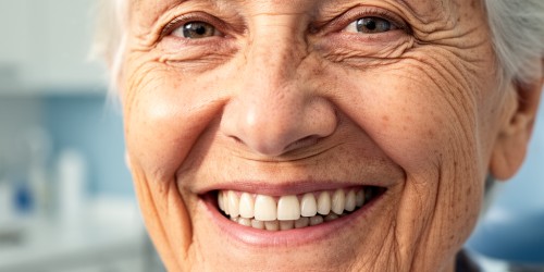 Implante Dentário em Idosos: É Seguro?